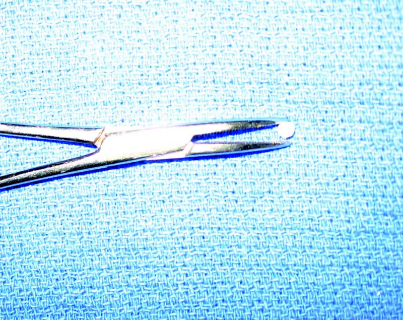 The cisplatin bead is held at the tips of mosquito forceps for implantation into a stab incision.