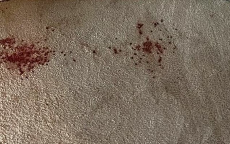 bloodstains on carpet