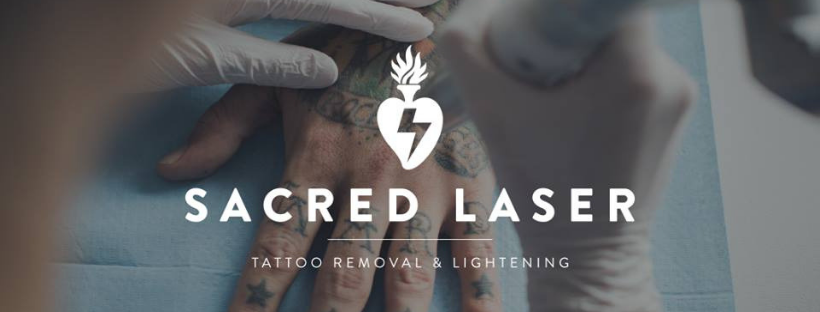 Sacred Laser has affordable and effective tattoo removal and lightening by New Zealand's top specialists.