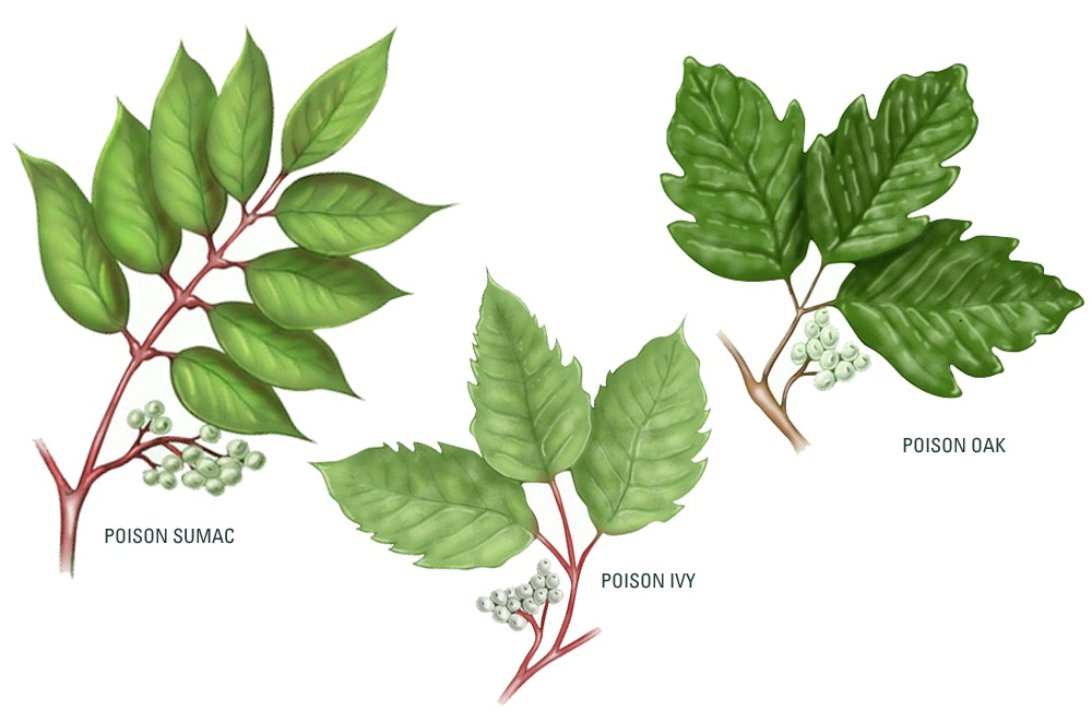 Poison Ivy - Karas Health Care