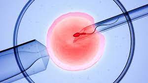 In-Vitro Fertilization (IVF)