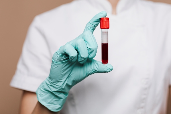 nurse-holding-blood-test-tube