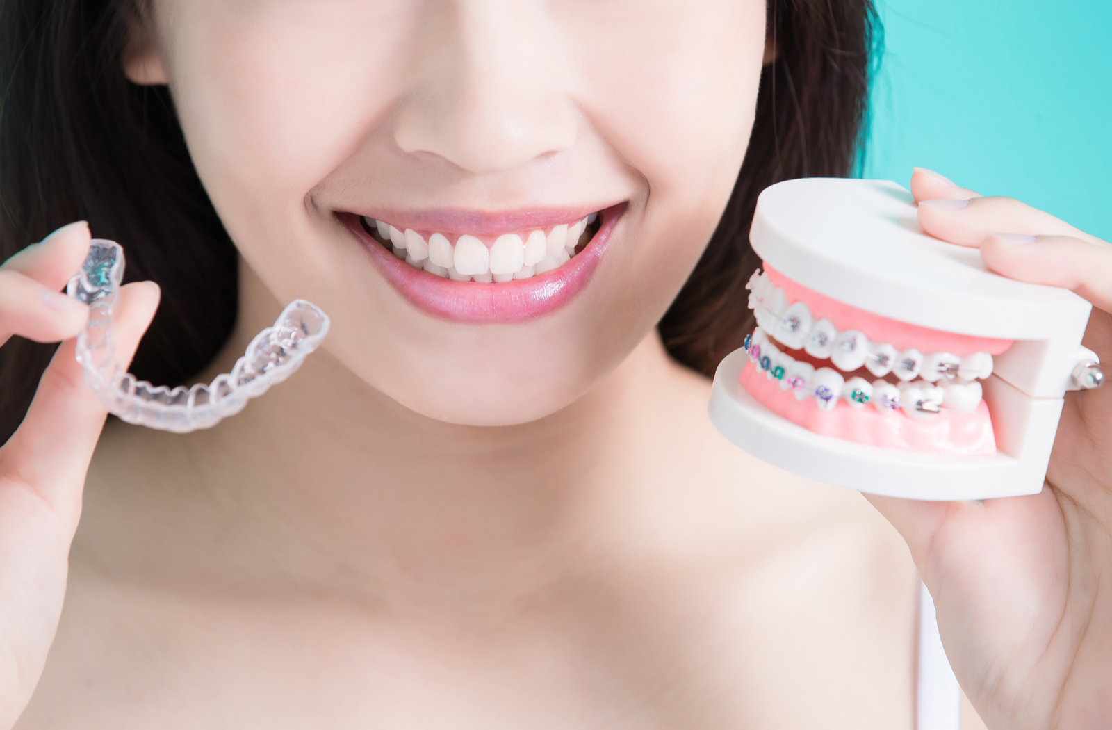 woman smiling holding an Invisalign aligner in one hand and a model of teeth with braces on them in the other