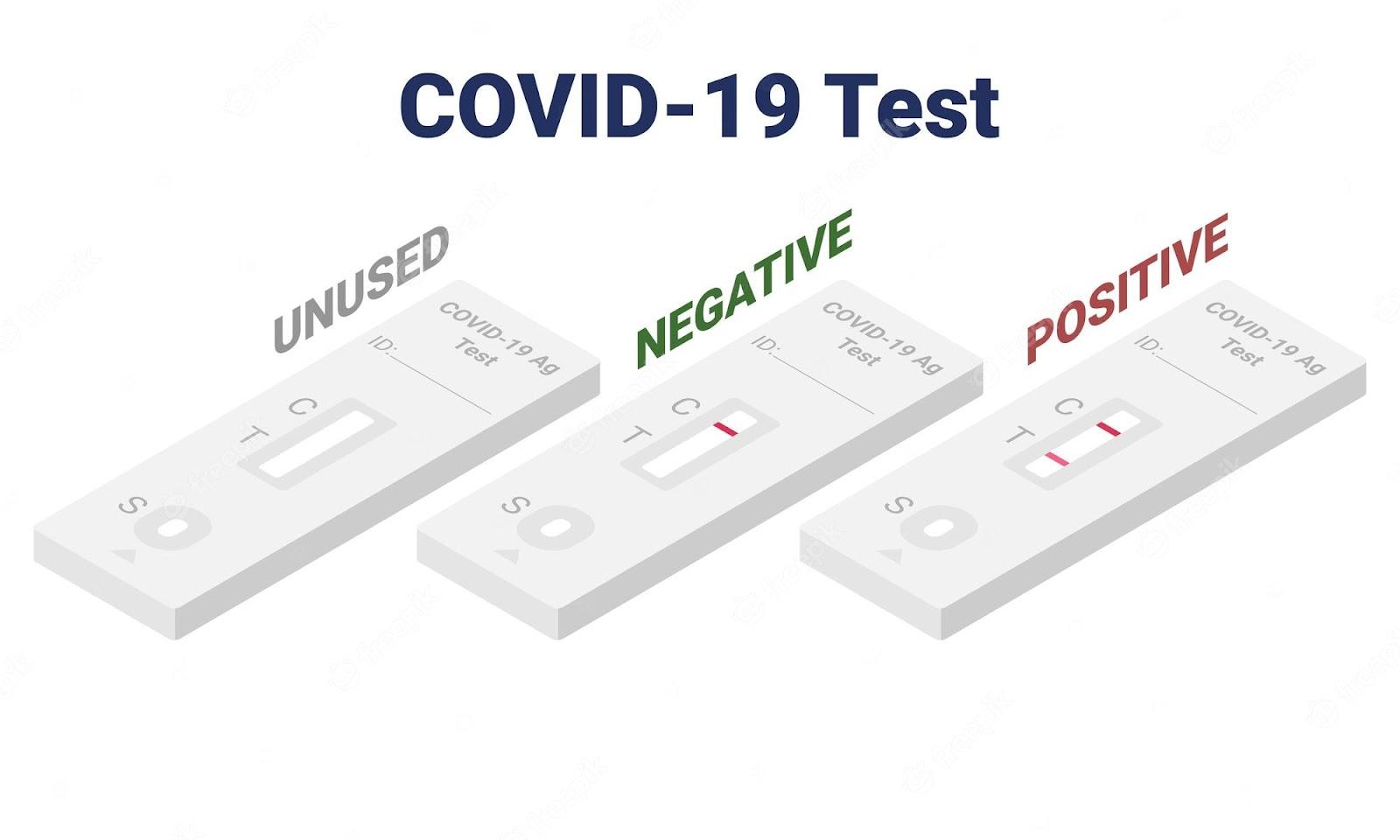 Image of Covid 19 Test Results via Freeimages.