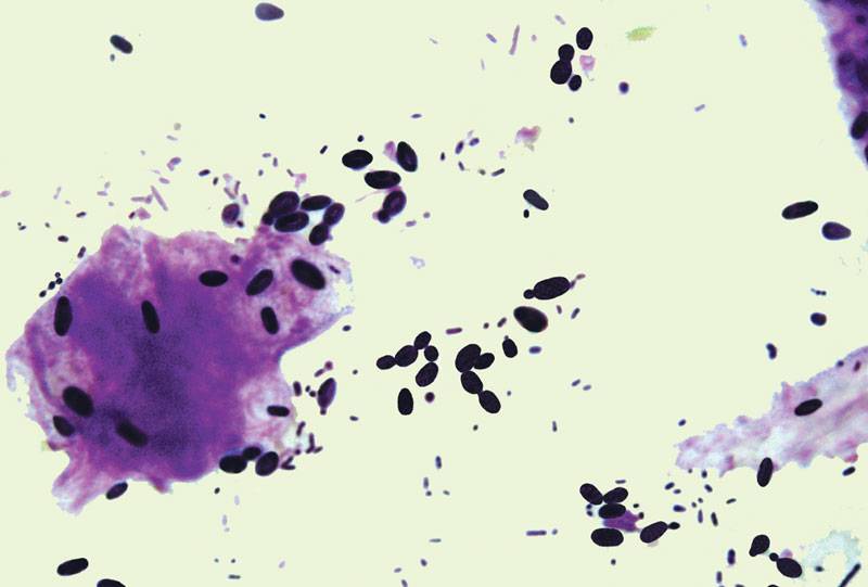 Candida albicans in an avian fecal Gram’s stain