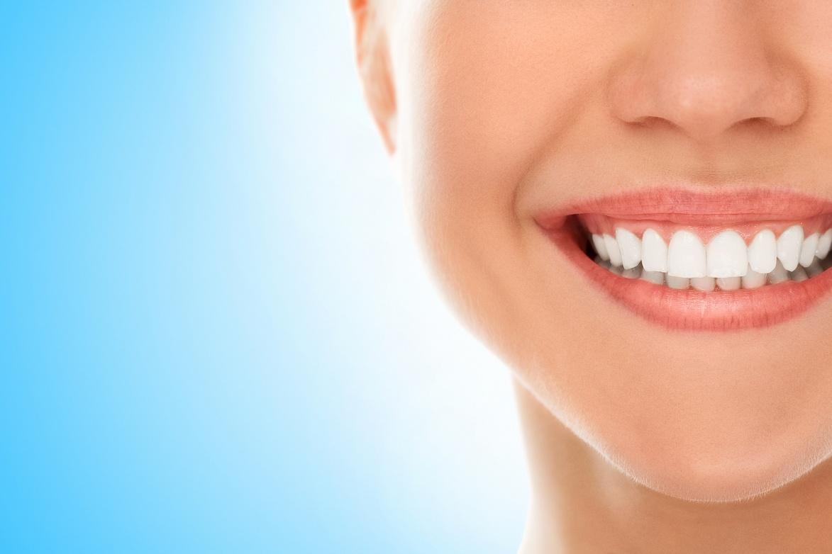 Newmarket teeth whitening service