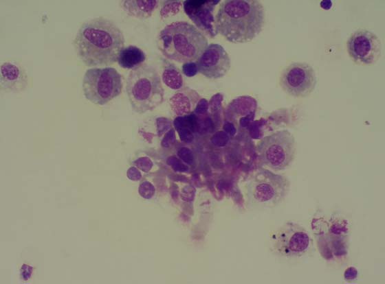 Multiple macrophages together with a clump of epithelial cells in a TA from a horse not showing signs of respiratory disease.