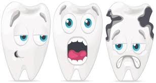 Image result for decayed teeth clip art