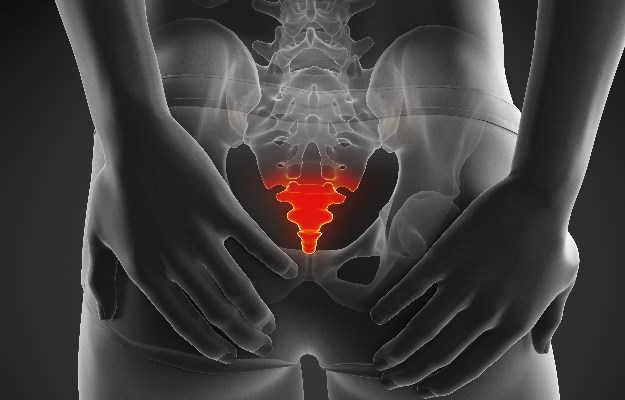 Coccydynia (Tailbone Pain)