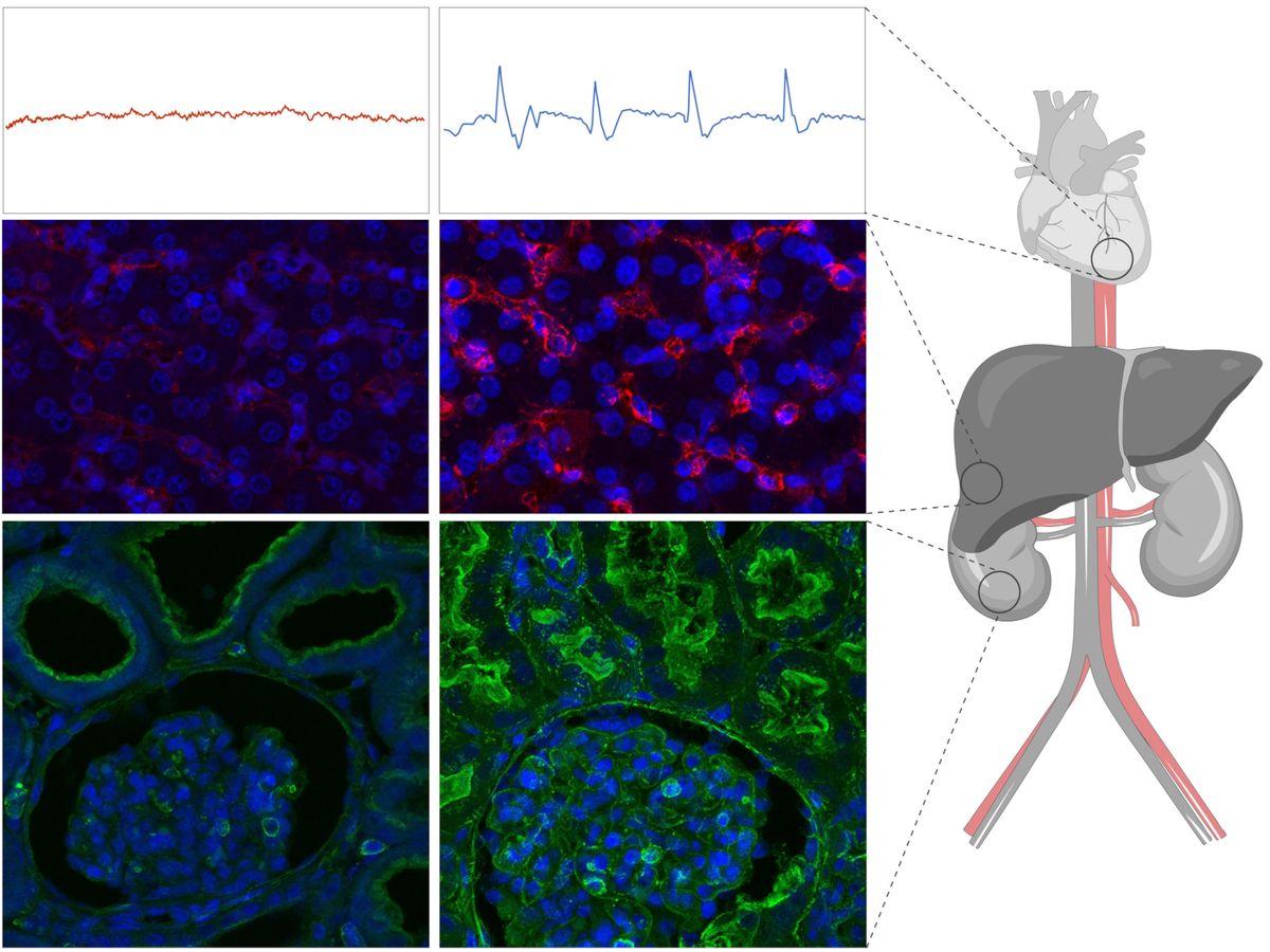 Images comparing control electrocardiogram signals and tissue stainings (left) to those of the experimental group.<br><br>