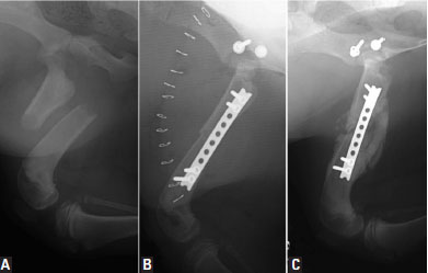 A femoral fracture in a 4-month-old dog