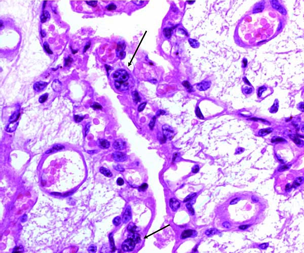 Binucleate cells at arrows. Note capillaries in trophoblast