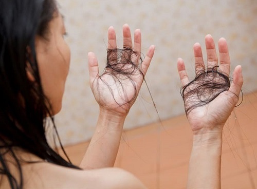 Rụng tóc nhiều gây ảnh hưởng nghiêm trọng đến chất lượng cuộc sống
