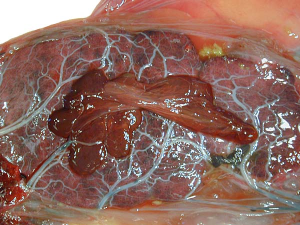 Fetal surface of zonary placenta with small yellow meconium particles at margin