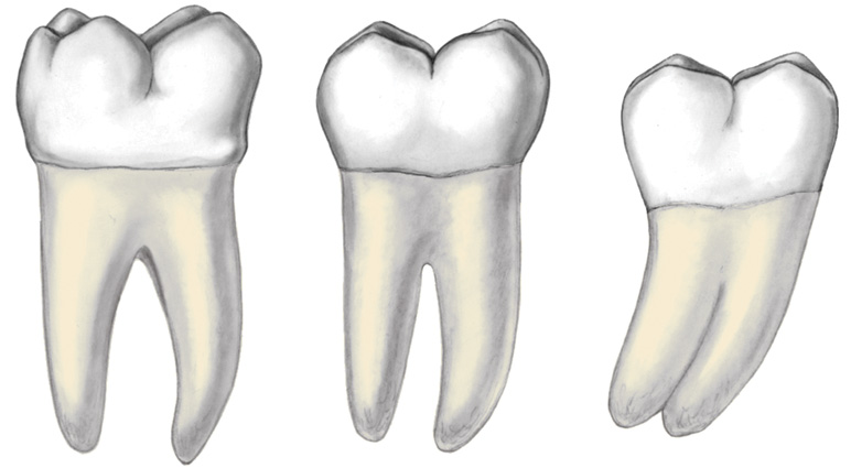 Morpho 107 Copy Austin Dental Careers