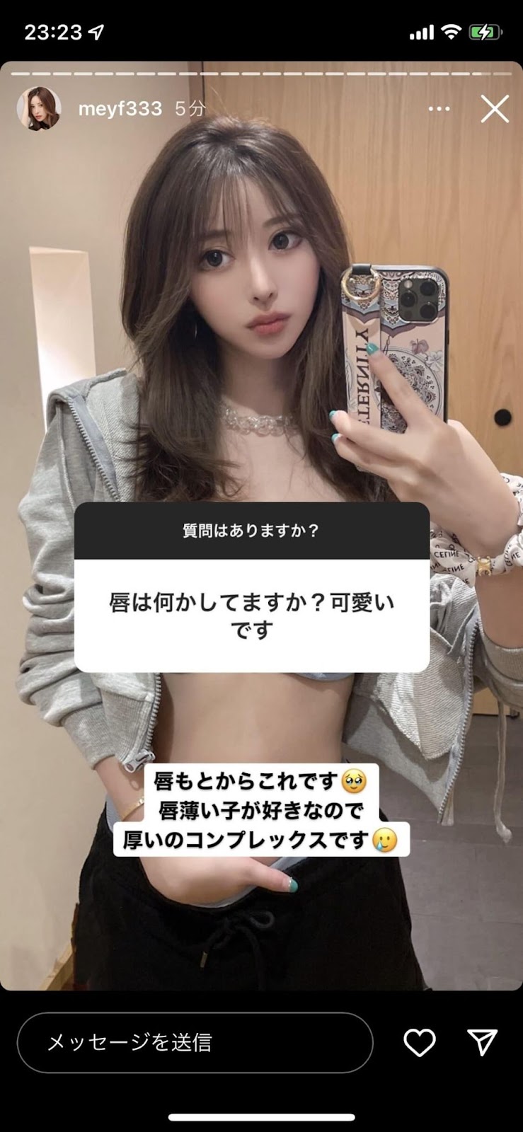 唇の美容整形について回答した藤咲めいさんのインスタ質問箱