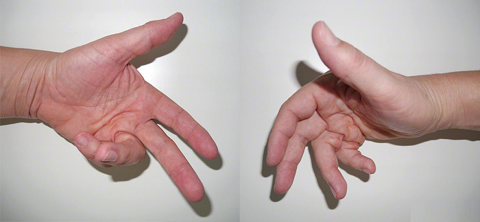 A close-up of hands shaking

Description automatically generated with medium confidence