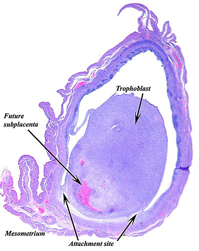Cross section through very slightly older implantation site.