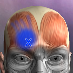 Muscle Trigger Point Anatomy apk Download