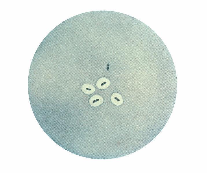 Fichier: Pneumococcus CDC PHIL 2113.jpg