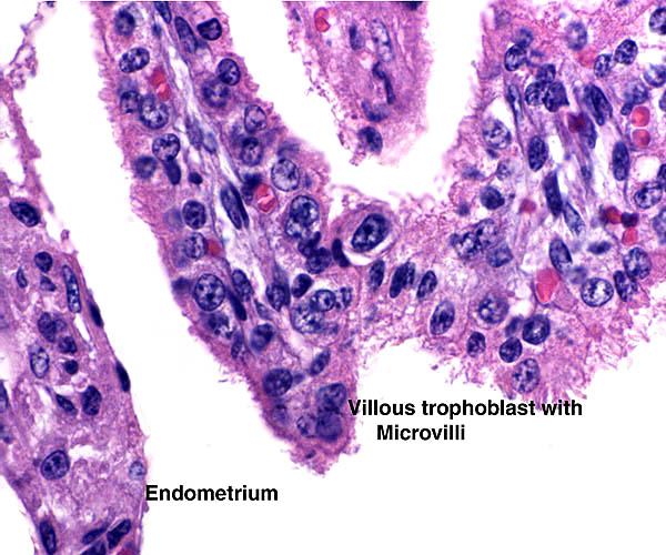 Tip of immature villus with microvillous trophoblastic surface and some giant nuclei