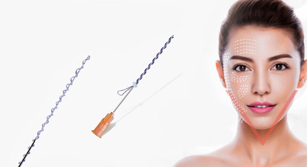 Chỉ collagen được sử dụng khá phổ biến hiện nay, chúng có giá thành phù hợp với túi tiền của đại đa số khách hàng.