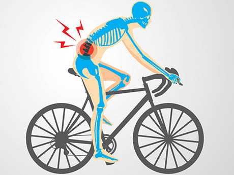 Riding with the wrong saddle could cause discomfort and numbness in your sit bone area.