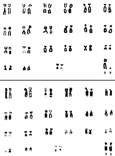 Karyotypes of male and female Presbytis senex