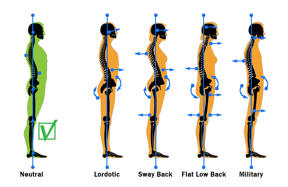 C:\Users\Rebekah\AppData\Local\Microsoft\Windows\INetCache\Content.Word\Types of standing posture.png