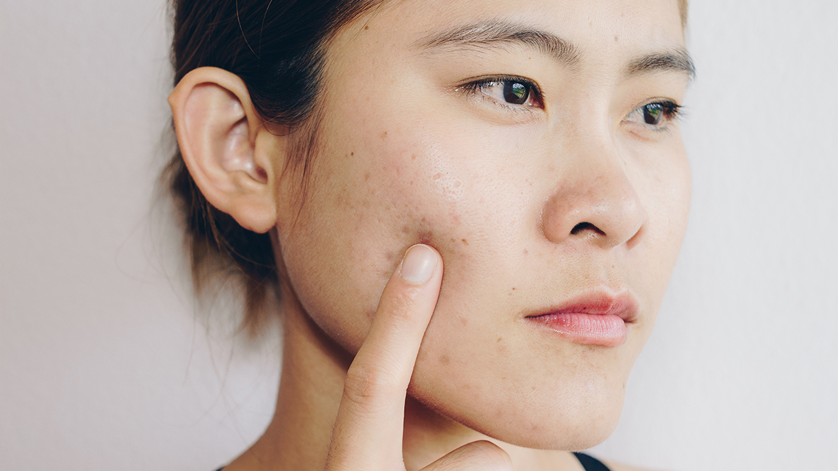 Understanding Pores Your Key To Clearer Skin