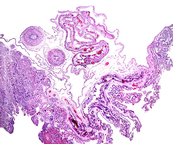 A placental portion with coiled amnion and allantoic membrane above the chorion