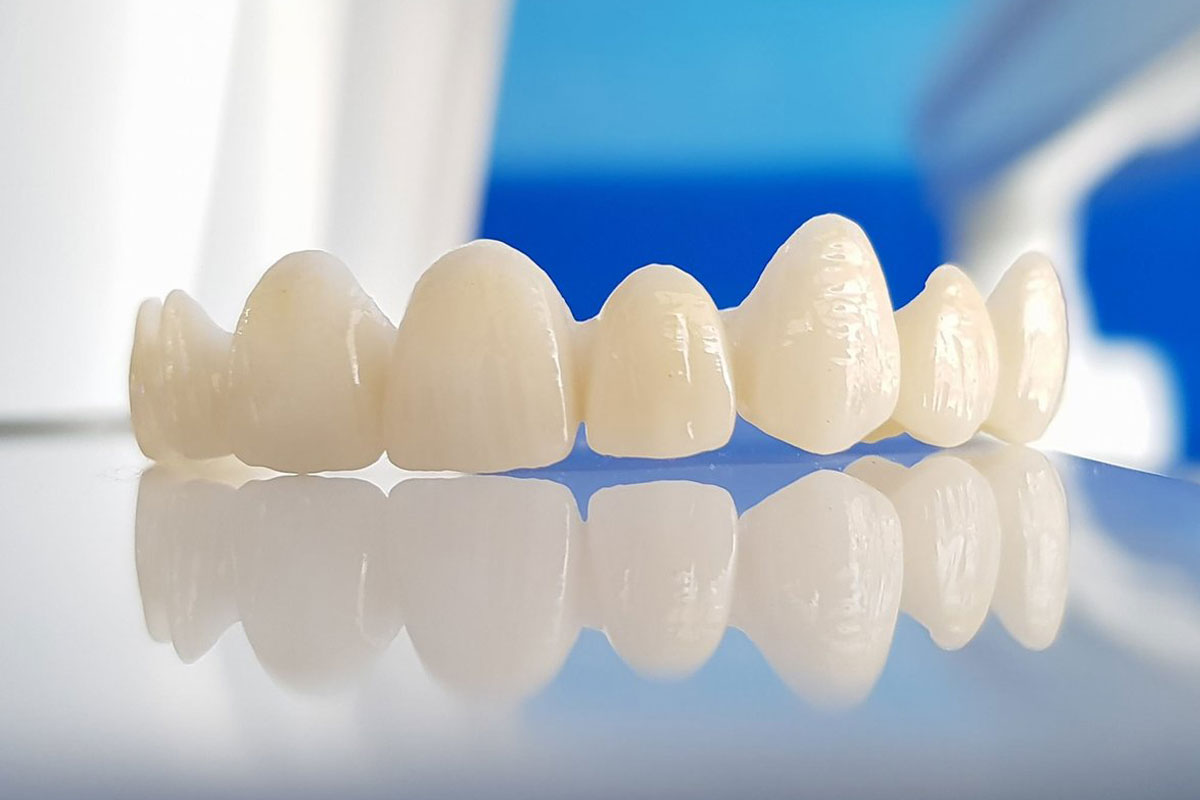  Giá bọc răng sứ Zirconia là bao nhiêu?