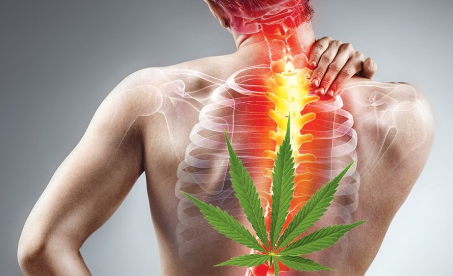 Medical Marijuana Chronic Pain