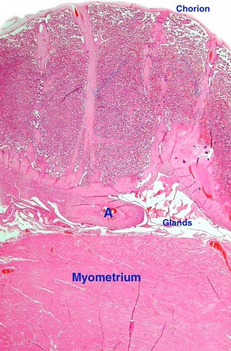 Guenon placenta attached to myometrium