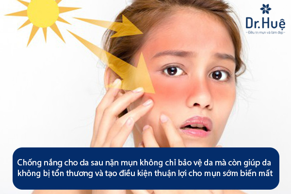 Da mụn có nên dùng kem chống nắng gì 