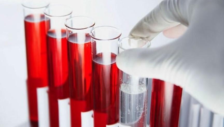 Общий анализ крови: норма и расшифровка результатов | Статьи МЦ «Диагностика
