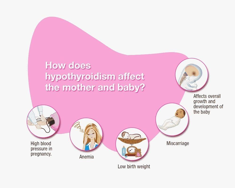 Hypothyroidism in pregnancy