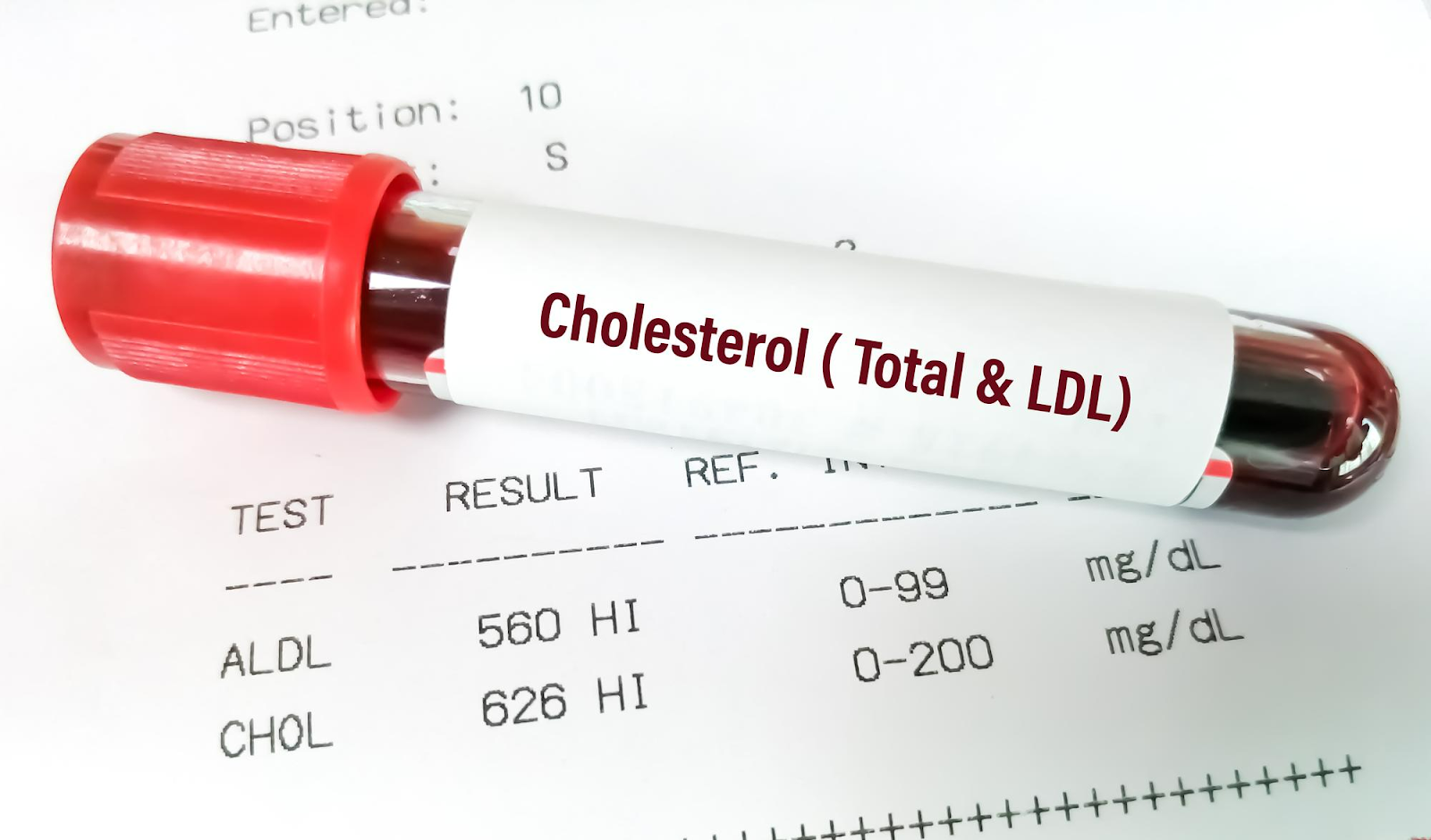Tipuri de colesterol și factori de influență