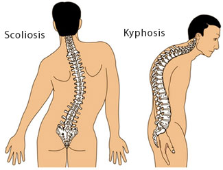  Posture and Postural Defects