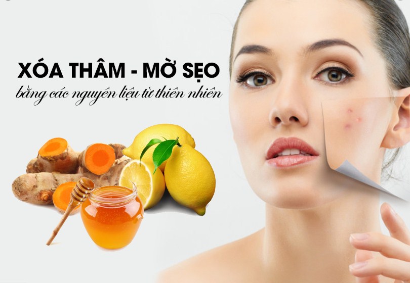 trị mụn thâm tại nhà bằng thiên nhiên