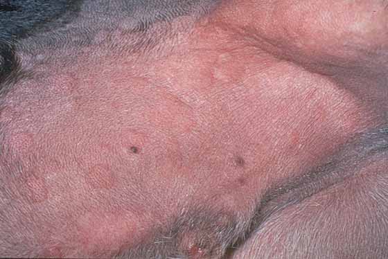 Wheal - A sharply circumscribed, raised, edematous lesion that appears and disappears within minutes to hours