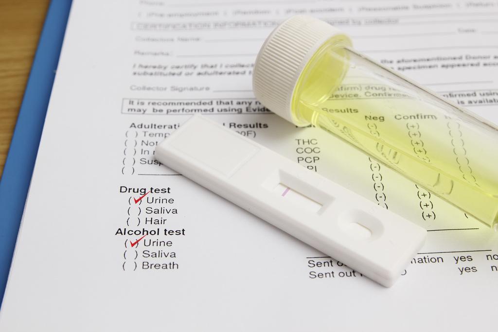 Can I See My Pre-Employment Drug Test Results?