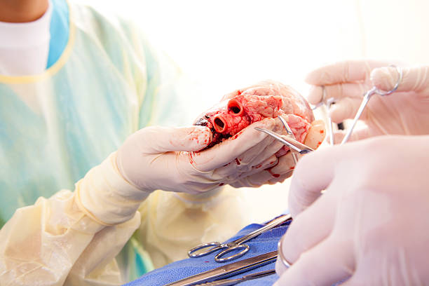 Why Do You Need Cardiac Surgery?
