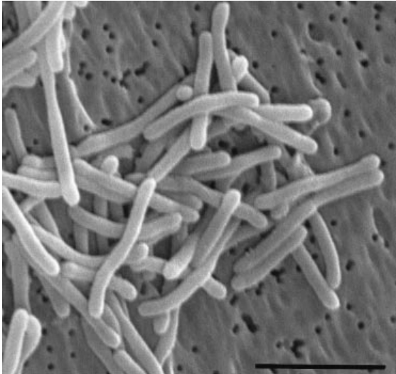 Microscopia eletrônica de varredura de Salinibacter ruber