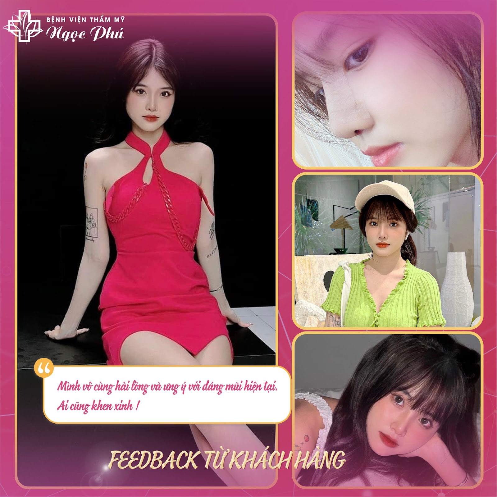 Hiện nay, tại Thẩm Mỹ Việt Nam ứng dụng nhiều công nghệ nâng mũi như Nâng mũi cấu trúc Collagen với hiệu quả được cải thiện, vượt trội hơn so với công nghệ nâng mũi cũ.