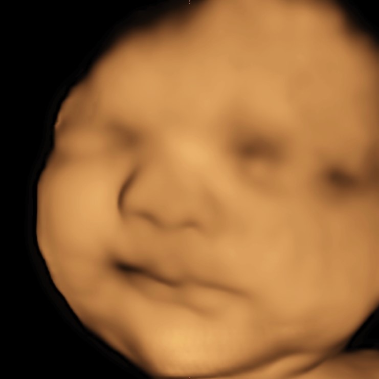 What is the Difference Between 3D and 4D Ultrasound? | Over the Womb