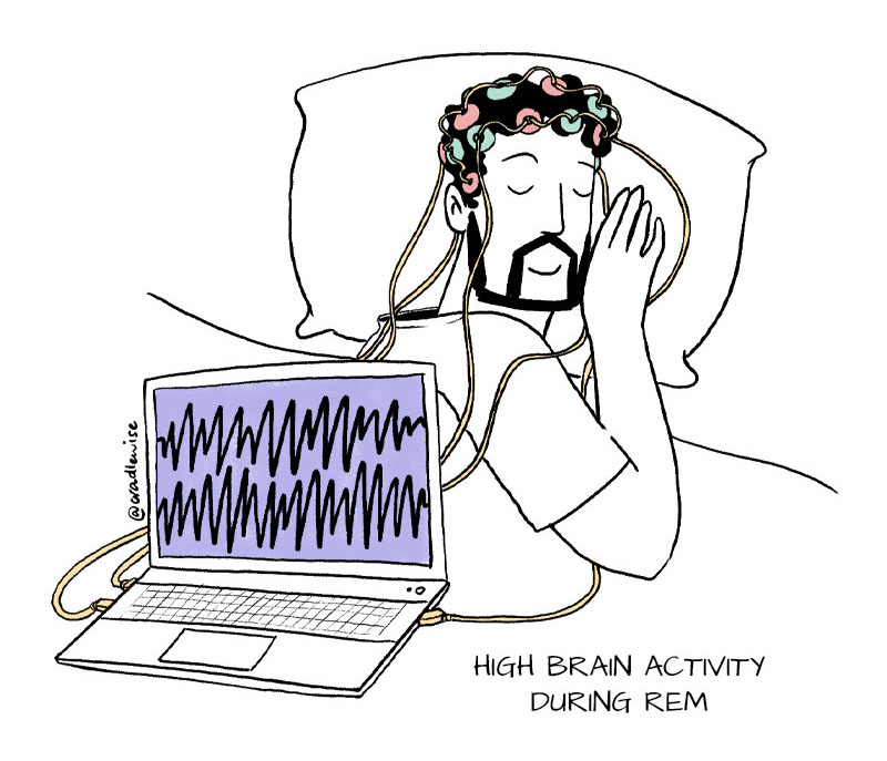 Brainwaves of a man measured while he's in REM sleep.