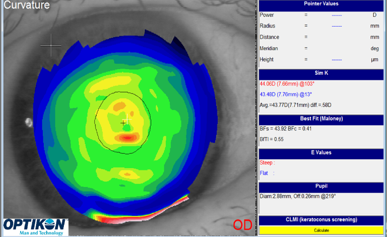 Ocular surface dry eye treatment