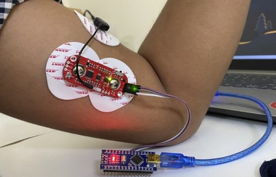 Myoware Muscle Sensor Arduino