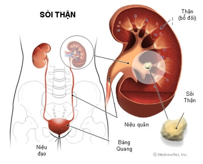 Gây tổn thương cho thận